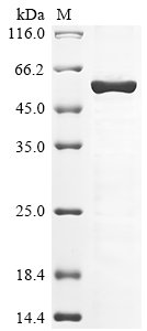 Human Chromobox protein homolog 8 (CBX8) Recombinant Protein, N-His, Homo sapiens (Human), E.coli, N-terminal 6xHis-tagged, 49.4 kDa, purity >≥ 85% as determined by SDS-PAGE.