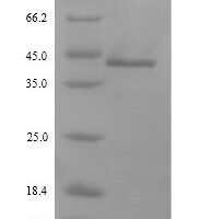 Ambrosia artemisiifolia Pectate lyase 1 Recombinant Protein, N-His, aa 26–398, Yeast - BioCrest Sci