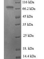 Human Cyclic AMP-dependent transcription factor ATF-2 (ATF2) Recombinant Protein - BioCrest Sci