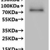 Human Transient receptor potential cation channel subfamily V member 6 (TRPV6)-VLPs Recombinant Protein - BioCrest Sci