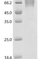 Mouse Perilipin-2 (Plin2) Recombinant Protein, C-10His - BioCrest Sci