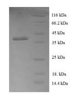 Human Cytochrome c oxidase assembly factor 1 homolog (COA1), partial Recombinant Protein - BioCrest Sci