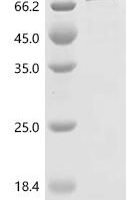 Human Alanine--tRNA ligase, mitochondrial (AARS2), partial Recombinant Protein, C-His, aa 24–650 - BioCrest Sci