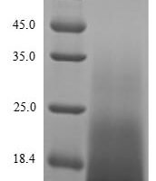 Mouse Aquaporin-4 (Aqp4), partial Recombinant Protein - BioCrest Sci