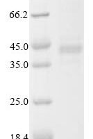 Lake Victoria marburgvirus Envelope glycoprotein (GP), partial Recombinant Protein - BioCrest Sci