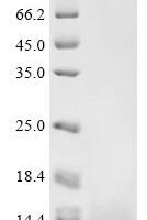 Escherichia coli Colicin-E5 (col), partial Recombinant Protein - BioCrest Sci