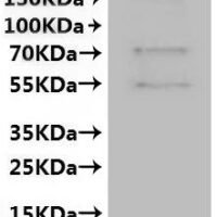 Human Gap junction alpha-5 protein (GJA5)-VLPs, Fluorescent Recombinant Protein - BioCrest Sci