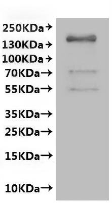 Human Gap junction alpha-5 protein (GJA5)-VLPs, Fluorescent Recombinant Protein, Mammalian cell, C-terminal EGFP-tagged, 67.2 kDa, purity >VLPs