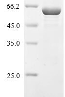 Human Galectin-3-binding protein (LGALS3BP) Recombinant Protein - BioCrest Sci