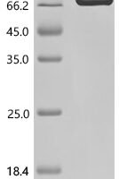 Escherichia coli Colicin-Ia (cia) (626:I→I-GYTFTNYGMNWVKQAPGQGLKWMGWQQHYITPLT) Recombinant Protein - BioCrest Sci