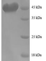 Human Transforming protein RhoA (RHOA), partial Recombinant Protein - BioCrest Sci