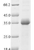 Mouse Troponin I, fast skeletal muscle (Tnni2) Recombinant Protein - BioCrest Sci