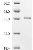 Danio rerio E3 ubiquitin-protein ligase TRIM33 (trim33), partial Recombinant Protein - BioCrest Sci