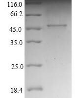 Human NADH dehydrogenase [ubiquinone] 1 beta subcomplex subunit 10 (NDUFB10) Recombinant Protein - BioCrest Sci