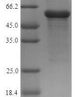 Human Acid ceramidase (ASAH1) Recombinant Protein, N-His-SUMO - BioCrest Sci