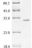 Human Butyrophilin-like protein 2 (BTNL2), Partial Recombinant Protein, C-His, Isoform 4 - BioCrest Sci