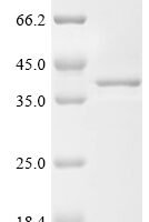 Mouse Single-stranded DNA cytosine deaminase (Aicda) Recombinant Protein - BioCrest Sci