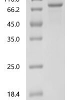 Saccharomyces cerevisiae 1,3-beta-glucan synthase component FKS1 (FKS1), partial Recombinant Protein - BioCrest Sci
