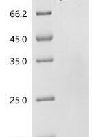 Acinetobacter baumannii Outer membrane protein Omp38 (omp38), Biotinylated Recombinant Protein - BioCrest Sci