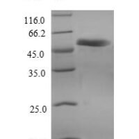 Human Receptor-interacting serine/threonine-protein kinase 3 (RIPK3) Recombinant Protein, N-His - BioCrest Sci