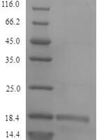 Calloselasma rhodostoma Snaclec rhodocytin subunit alpha Recombinant Protein - BioCrest Sci