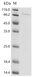 Human herpesvirus 1 Envelope glycoprotein B (gB), partial Recombinant Protein, N-10His/C-Myc, aa 31–774, Human herpes simplex virus 1, Mammalian cell, N-terminal 10xHis-tagged and C-terminal Myc-tagged, 87.7 kDa, purity >≥ 85% as determined by SDS-PAGE.