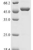 Thermotoga maritima 5-methylthioadenosine/S-adenosylhomocysteine deaminase (mtaD) Recombinant Protein - BioCrest Sci