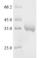 Dendroaspis angusticeps Natriuretic peptide DNP Recombinant Protein, C-hFc1 - BioCrest Sci