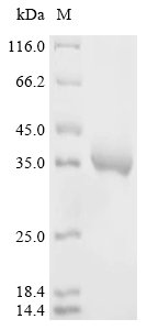 Dendroaspis angusticeps Natriuretic peptide DNP Recombinant Protein, C-hFc1, Dendroaspis angusticeps (Eastern green mamba) (Naja angusticeps), Mammalian cell, C-terminal hFc1-tagged, 33.1 kDa, purity >≥ 95% as determined by SDS-PAGE.