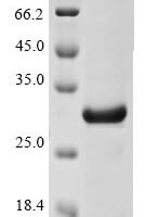 Human herpesvirus 1 Glycoprotein C (GC), partial Recombinant Protein - BioCrest Sci