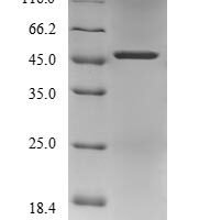 Human Paraneoplastic antigen Ma1 (PNMA1) Recombinant Protein, N-10His-B2M-JD/C-Myc - BioCrest Sci