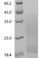 Artemisia vulgaris Art v 2 allergen (art v 2) Recombinant Protein, C-His, aa 24–162, Yeast - BioCrest Sci