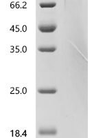 Human BDNF/NT-3 growth factors receptor (NTRK2), partial Recombinant Protein - BioCrest Sci