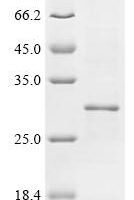 Escherichia coli Ferrichrome outer membrane transporter/phage receptor (fhuA), partial Recombinant Protein - BioCrest Sci