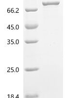 Rat Coiled-coil domain containing 112 (Ccdc112) Recombinant Protein, N-His-SUMO - BioCrest Sci