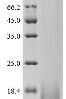 Human C-C motif chemokine 1 (CCL1) Recombinant Protein, N-10His-HA, aa 24–96, Mammalian cell - BioCrest Sci