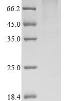 Human Plasminogen (PLG) (R386Q) Recombinant Protein - BioCrest Sci