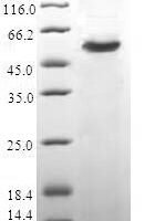 Human F-actin-capping protein subunit beta (CAPZB) Recombinant Protein - BioCrest Sci
