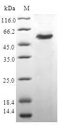 Human F-actin-capping protein subunit beta (CAPZB) Recombinant Protein, Homo sapiens (Human), E.coli, N-terminal GST-tagged, 57.6 kDa, purity >≥ 90% as determined by SDS-PAGE.