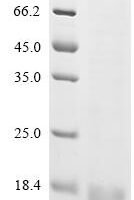 Human cytomegalovirus Uncharacterized protein UL131 (UL131) Recombinant Protein, C-His - BioCrest Sci