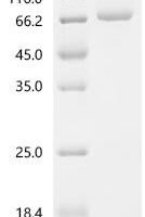 Mouse Serine/threonine-protein phosphatase 2A 65 kDa regulatory subunit A alpha isoform (Ppp2r1a) Recombinant Protein - BioCrest Sci