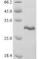 Rat Metallothionein-3 (Mt3) Recombinant Protein - BioCrest Sci