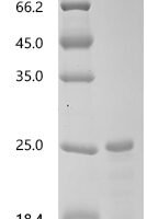 Lama glama Interleukin-2 (IL2) Recombinant Protein, N-His - BioCrest Sci