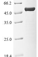 Arabidopsis thaliana Alpha-1,3-mannosyl-glycoprotein 2-beta-N-acetylglucosaminyltransferase (GNTI), partial Recombinant Protein - BioCrest Sci