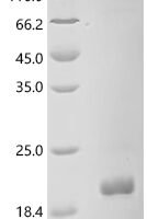 PRRSV HB-2 (sh)/2002 ORF2b structual protein, partial Recombinant Protein - BioCrest Sci