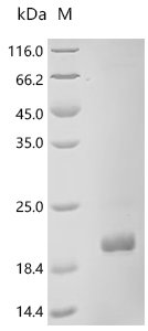 PRRSV HB-2 (sh)/2002 ORF2b structual protein, partial Recombinant Protein, PRRSV HB-2(sh)/2002, E.coli, N-terminal 6xHis-SUMO-tagged, 15.3 kDa, purity >≥ 95% as determined by SDS-PAGE.