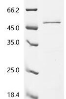 Human Filaggrin (FLG), partial Recombinant Protein, C-His - BioCrest Sci