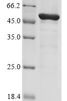 Aeromonas sobria Aerolysin (asa1) Recombinant Protein - BioCrest Sci