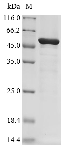 Aeromonas sobria Aerolysin (asa1) Recombinant Protein, Aeromonas sobria, E.coli, N-terminal 10xHis-tagged and C-terminal Myc-tagged, 54.2 kDa, purity >≥ 85% as determined by SDS-PAGE.