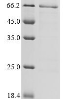 Human Interleukin-26 (IL26),Biotinylated Recombinant Protein - BioCrest Sci